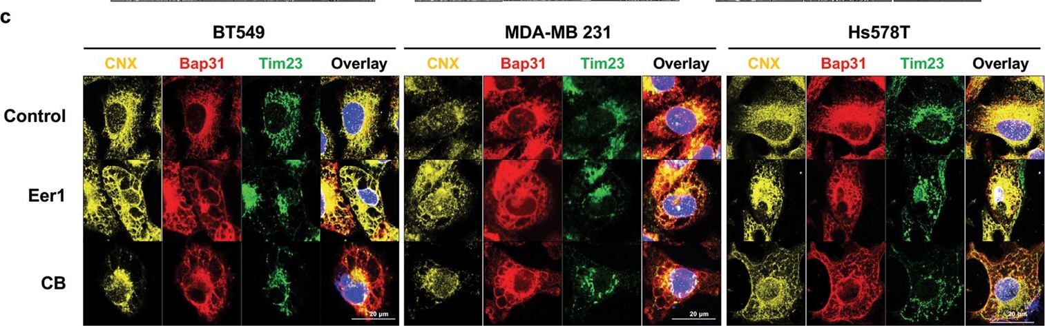 Fig.3.C showing Immunohistochemistry-immunofluorescence in a Homo sapiens (Human) sample from the publication: Akt enhances the vulnerability of cancer cells to VCP/p97 inhibition-mediated paraptosis.