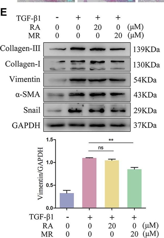 Fig.4.E showing Western Blotting in a Mus musculus (House mouse) sample from the publication: Anti-pulmonary fibrosis activity analysis of methyl rosmarinate obtained from Salvia castanea Diels f. tomentosa Stib. using a scalable process.