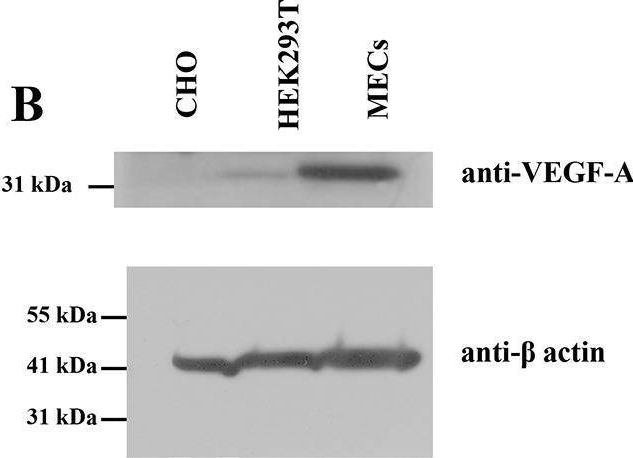 Fig.2.B showing Western Blotting in a Cricetulus griseus (Chinese hamster) sample from the publication: VEGFR-2 conformational switch in response to ligand binding.