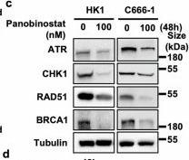 Fig.6.C showing Western Blotting in a Homo sapiens (Human) sample from the publication: Large-scale and high-resolution mass spectrometry-based proteomics defines molecular subtypes of nasopharyngeal carcinoma for therapeutic targeting.