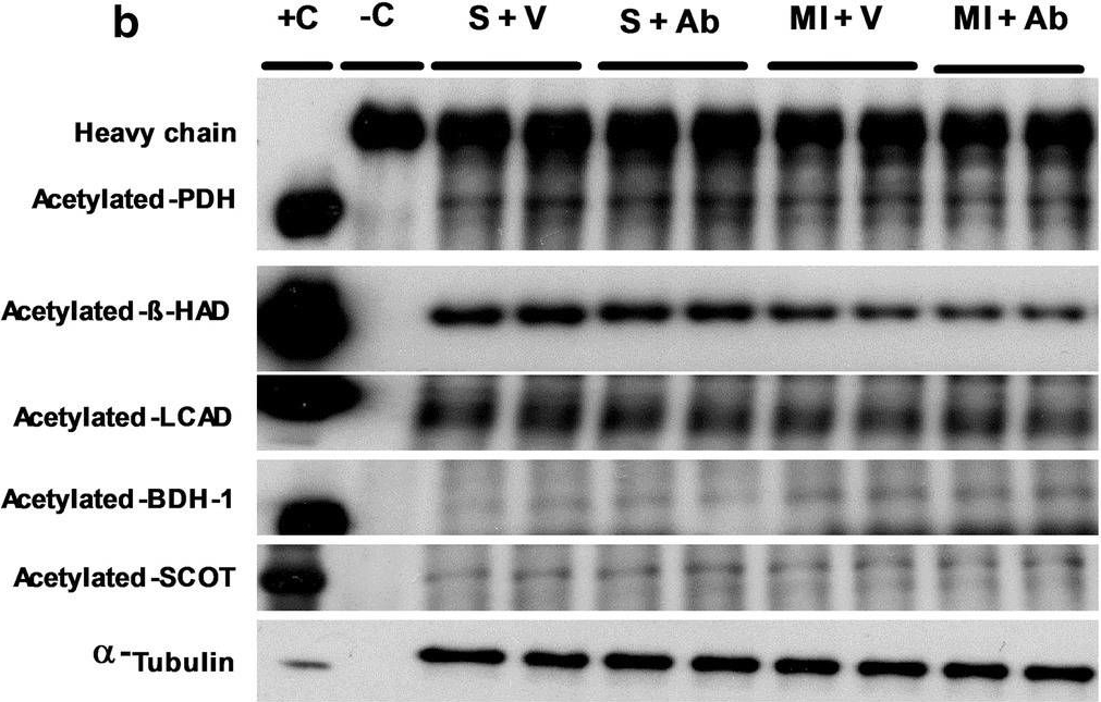 Fig.8.B showing Western Blotting in a Mus musculus (House mouse) sample from the publication: Targeting the glucagon receptor improves cardiac function and enhances insulin sensitivity following a myocardial infarction.
