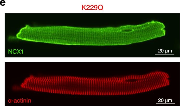 Fig.6.E showing Immunocytochemistry-immunofluorescence in a Mus musculus (House mouse) sample from the publication: Cardiac function is regulated by the sodium-dependent inhibition of the sodium-calcium exchanger NCX1.