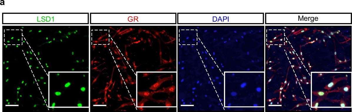 Fig.6.A showing Immunocytochemistry-immunofluorescence in a Homo sapiens (Human) sample from the publication: LSD1 inhibition circumvents glucocorticoid-induced muscle wasting of male mice.