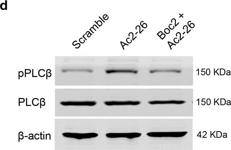Fig.5.D showing Western Blotting in a Mus musculus (House mouse) sample from the publication: The mechanism of Annexin A1 to modulate TRPV1 and nociception in dorsal root ganglion neurons.