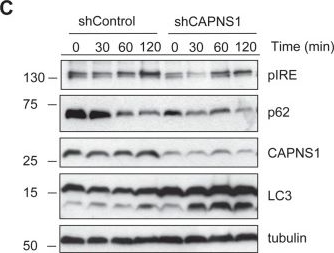 Fig.1.C showing Western Blotting from the publication: Calpain mobilizes Atg9/Bif-1 vesicles from Golgi stacks upon autophagy induction by thapsigargin.