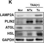 Fig.2.K showing Western Blotting from the publication: Adiponectin preserves follicles through ADIPOR1/ADIPOR2-driven fatty acid metabolism.