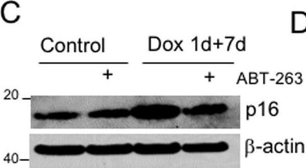 Fig.4.C showing Western Blotting from the publication: Efficacy and limitations of senolysis in atherosclerosis.