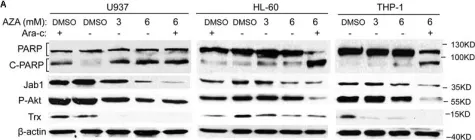 Fig.4.A showing Western Blotting in a Homo sapiens (Human) sample from the publication: Azelaic Acid Exerts Antileukemic Activity in Acute Myeloid Leukemia.