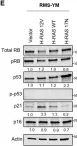 Fig.6.E showing Western Blotting from the publication: Expression of oncogenic HRAS in human Rh28 and RMS-YM rhabdomyosarcoma cells leads to oncogene-induced senescence.