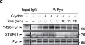 Fig.5.C showing Western Blotting in a Rattus norvegicus (Rat) sample from the publication: Activity-regulated trafficking of the palmitoyl-acyl transferase DHHC5.