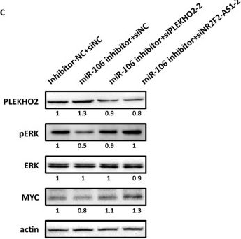 Fig.8.C showing Western Blotting from the publication: The miR-106b/NR2F2-AS1/PLEKHO2 Axis Regulates Migration and Invasion of Colorectal Cancer through the MAPK Pathway.