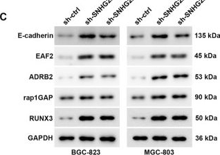 Fig.5.C showing Western Blotting from the publication: ELK4-mediated lncRNA SNHG22 promotes gastric cancer progression through interacting with EZH2 and regulating miR-200c-3p/Notch1 axis.