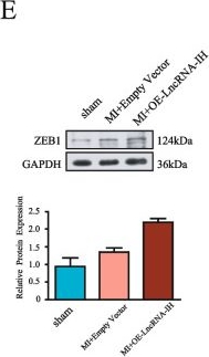 Fig.6.E showing Western Blotting in a Mus musculus (House mouse) sample from the publication: LncRNA nonnmmut065573 promotes post-myocardial infarction cardiac fibrosis and activates the TGF-β1/ZEB1 pathway.