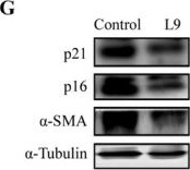 Fig.3.G showing Western Blotting in a Mus musculus (House mouse) sample from the publication: Lactobacillus paracasei L9 Ameliorates Pulmonary Fibrosis in Aged Mice via Gut-Lung Axis-Mediated Regulation of Immune Cell Migration.