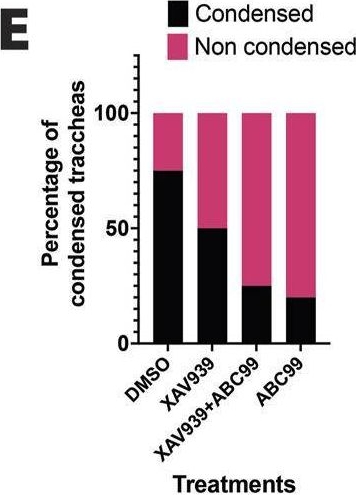 Fig.7.E from the publication: Wnt5a and Notum influence the temporal dynamics of cartilaginous mesenchymal condensations in developing trachea.