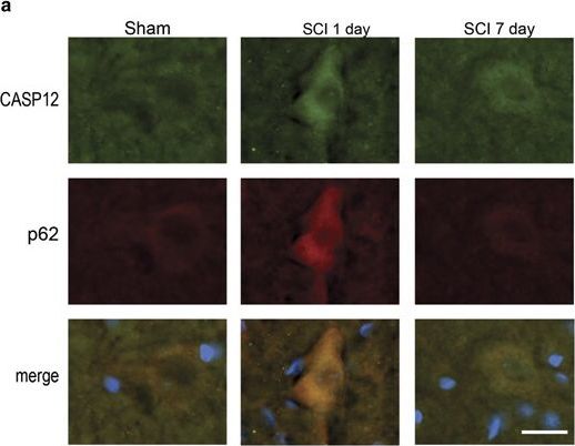 Disrupted autophagy after spinal cord injury is associated with ER stress and neuronal cell death.