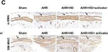 Fig.4.C showing Immunohistochemistry in a Cavia porcellus (Guinea Pig) sample from the publication: Tongjiang Hewei Decoction Improves Airway Hyperresponsiveness in Gastroesophageal Reflux Cough by Inhibiting ADAM33 and Epac1/Rap1 Pathway.