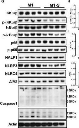 Recombinant Anti-NF-kB p65 (phospho S536) antibody [EP2294Y] (ab76302)