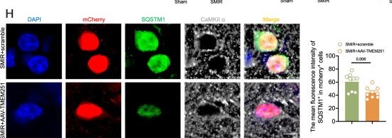 Fig.5.H showing Immunocytochemistry-immunofluorescence from the publication: TMEM251 loss-induced autophagy dysfunction in the anterior cingulate cortex contributes to chronic postoperative pain.
