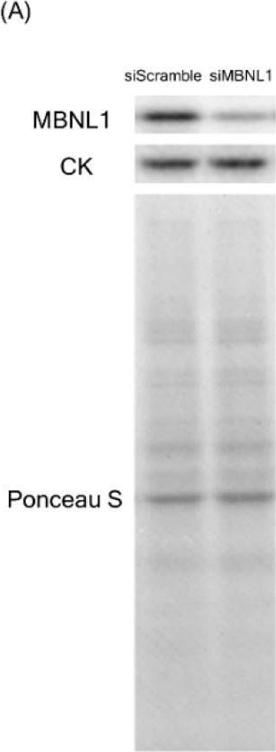Fig.1.A showing Western Blotting from the publication: MBNL1-Associated Mitochondrial Dysfunction and Apoptosis in C2C12 Myotubes and Mouse Skeletal Muscle.