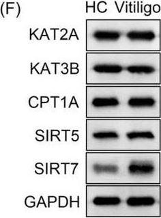 Fig.1.F showing Western Blotting from the publication: Mechanism of desuccinylation of G6PD mediated by SIRT7 to promote vitiligo disease progression.
