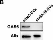 Fig.6.B showing Western Blotting in a Mus musculus (House mouse) sample from the publication: Extracellular vesicles containing GAS6 protect the liver from ischemia-reperfusion injury by enhancing macrophage efferocytosis via MerTK-ERK-COX2 signaling.