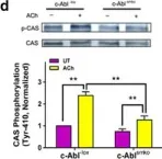 Fig.3.D showing Western Blotting from the publication: Role and regulation of Abelson tyrosine kinase in Crk-associated substrate/profilin-1 interaction and airway smooth muscle contraction.
