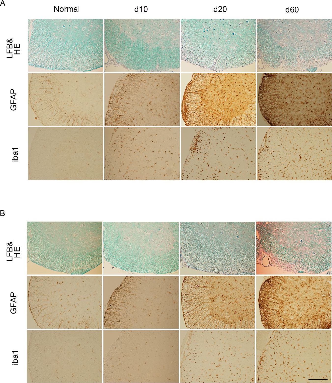 Delayed onset of experimental autoimmune encephalomyelitis in Olig1 deficient mice.