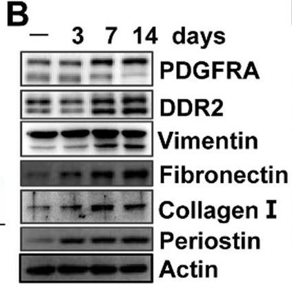 Fig.6.B showing Western Blotting from the publication: Single cell and lineage tracing studies reveal the impact of CD34+ cells on myocardial fibrosis during heart failure.