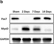 Fig.5.B showing Western Blotting from the publication: The response of muscle progenitor cells to cutaneous thermal injury.