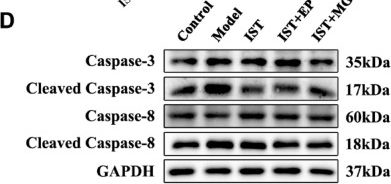 Fig.7.D showing Western Blotting from the publication: Modified Guilu Erxian Glue regulates Treg immune function to suppress bone marrow failure in aplastic anemia mice.