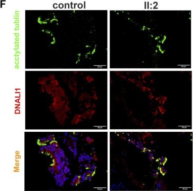 Fig.1.F showing Immunohistochemistry-immunofluorescence in a Homo sapiens (Human) sample from the publication: Homozygous mutation in DNAAF4 causes primary ciliary dyskinesia in a Chinese family.