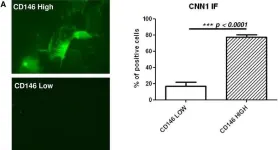Fig.4.A showing Immunocytochemistry-immunofluorescence from the publication: CD146 expression on mesenchymal stem cells is associated with their vascular smooth muscle commitment.