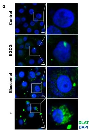 Fig.2.G showing Immunocytochemistry-immunofluorescence in a Homo sapiens (Human) sample from the publication: Epigallocatechin Gallate Promotes Cuproptosis via the MTF1/ATP7B Axis in Hepatocellular Carcinoma.