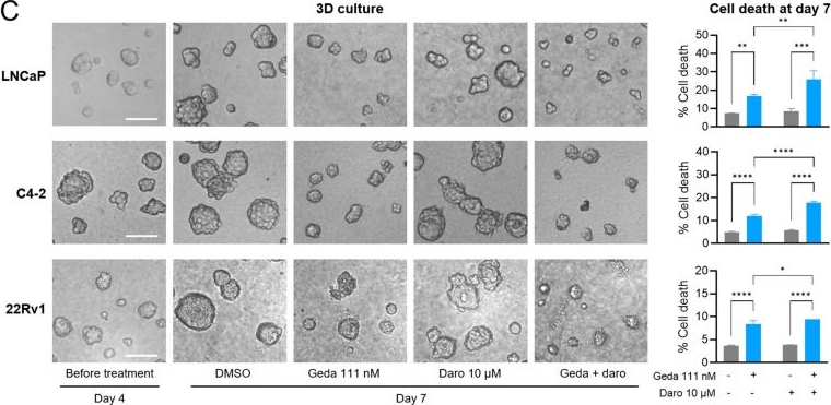 Fig.5.C from the publication: Synergistic Efficacy of Gedatolisib and Darolutamide in Prostate Cancer to Overcome Resistance to Androgen-Targeted Therapy.