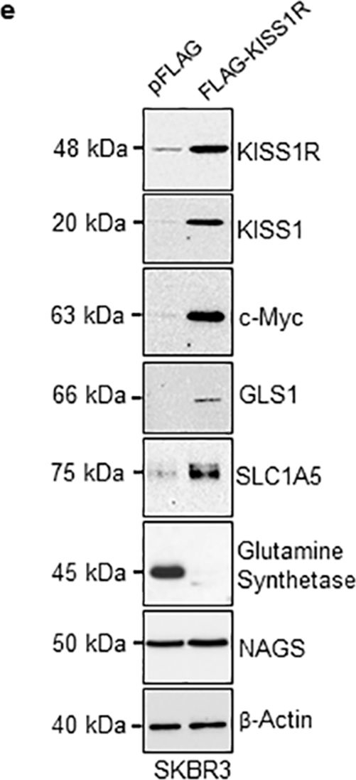 Fig.3.E showing Western Blotting in a Homo sapiens (Human) sample from the publication: G protein-coupled kisspeptin receptor induces metabolic reprograming and tumorigenesis in estrogen receptor-negative breast cancer.