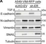 Fig.2.A showing Western Blotting from the publication: Opposing USP19 splice variants in TGF-β signaling and TGF-β-induced epithelial-mesenchymal transition of breast cancer cells.