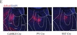 Fig.7.E showing Immunohistochemistry-immunofluorescence in a Mus musculus (House mouse) sample from the publication: Cell Type-Specific Modulation of Acute Itch Processing in the Anterior Cingulate Cortex.
