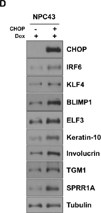 Fig.10.D showing Western Blotting in a Homo sapiens (Human) sample from the publication: Inhibition of the Integrated stress response by Epstein-Barr virus oncoprotein LMP1 attenuates epithelial cell differentiation and lytic viral reactivation.