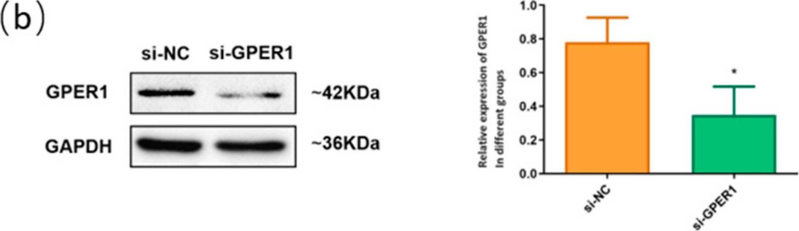 Fig.5.B showing Western Blotting in a Homo sapiens (Human) sample from the publication: Different Expression Pattern of G Protein-Coupled Estrogen Receptor GPER1 in Esophageal Squamous Cell Carcinoma and Adenocarcinoma.