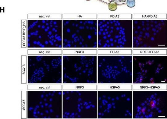 Fig.5.H showing Immunocytochemistry-immunofluorescence in a Homo sapiens (Human) sample from the publication: NRF3 suppresses squamous carcinogenesis, involving the unfolded protein response regulator HSPA5.