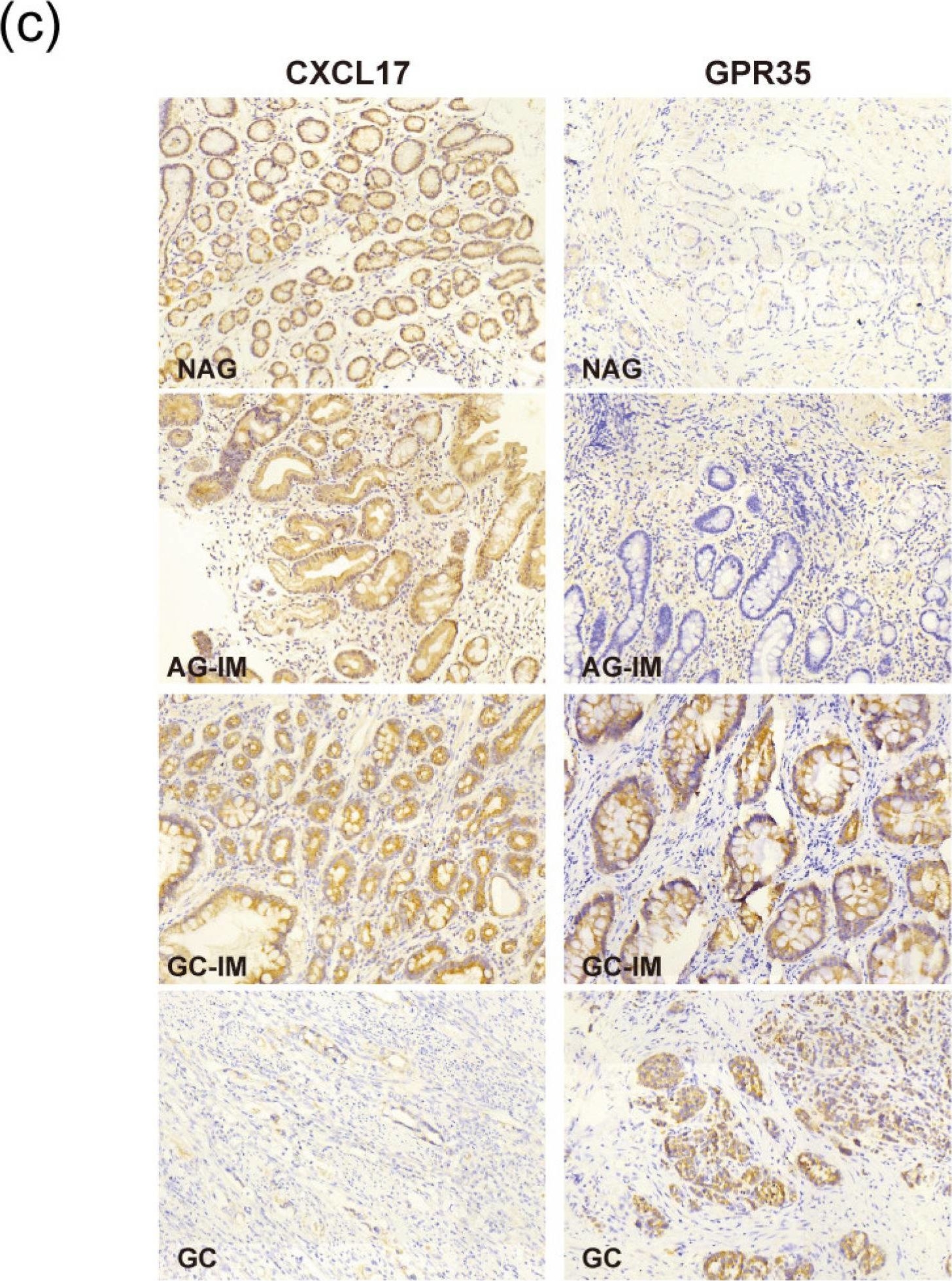 Fig.1.C showing Immunohistochemistry from the publication: Involvement of CXCL17 and GPR35 in Gastric Cancer Initiation and Progression.