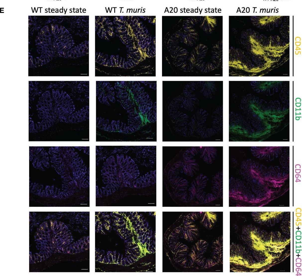 Fig.3.E showing Immunocytochemistry-immunofluorescence in a Mus musculus (House mouse) sample from the publication: Myeloid A20 is critical for alternative macrophage polarization and type-2 immune-mediated helminth resistance.