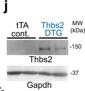 Fig.3.J showing Western Blotting in a Mus musculus (House mouse) sample from the publication: Thbs1 induces lethal cardiac atrophy through PERK-ATF4 regulated autophagy.