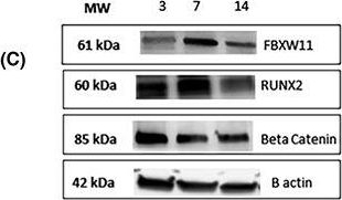 Fig.1.C showing Western Blotting in a Homo sapiens (Human) sample from the publication: Expression of FBXW11 in normal and disease-associated osteogenic cells.
