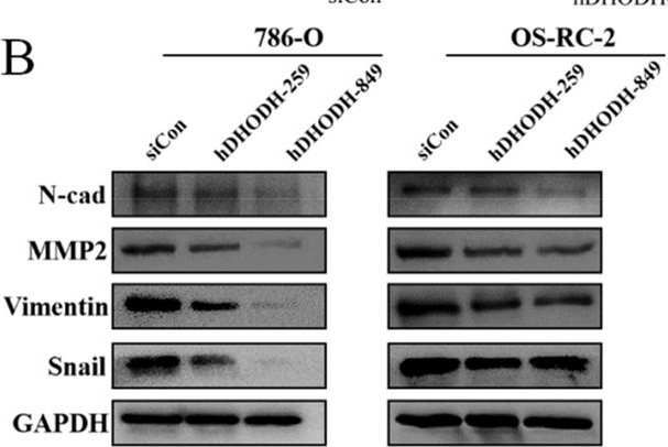 Fig.9.B showing Western Blotting from the publication: Bioinformatics analysis and experimental verification of the cancer-promoting effect of DHODH in clear cell renal cell carcinoma.