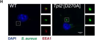 Fig.5.H showing Immunocytochemistry-immunofluorescence from the publication: TPL-2 kinase induces phagosome acidification to promote macrophage killing of bacteria.