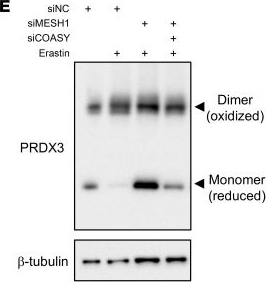 Fig.3.E showing Western Blotting in a Homo sapiens (Human) sample from the publication: MESH1-mediated coenzyme A degradation drives ferroptosis sensitivity and muscle pathology.