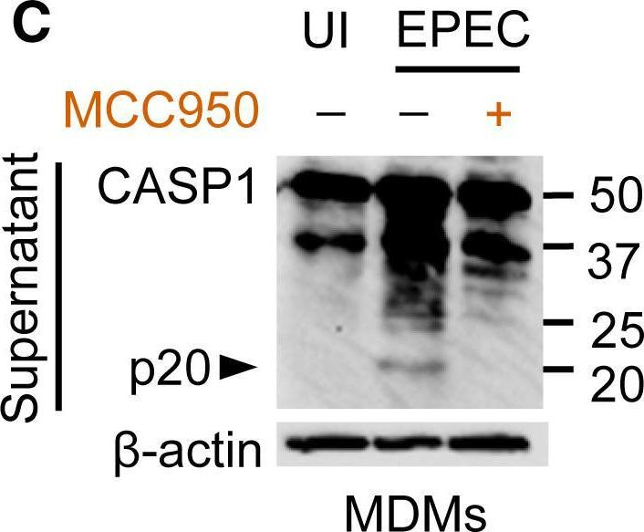Fig.1.C showing Western Blotting in a Homo sapiens (Human) sample from the publication: Enteropathogenic Escherichia coli Stimulates Effector-Driven Rapid Caspase-4 Activation in Human Macrophages.