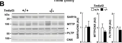 Fig.11.B showing Western Blotting from the publication: Inactivation of Tm6sf2, a Gene Defective in Fatty Liver Disease, Impairs Lipidation but Not Secretion of Very Low Density Lipoproteins.